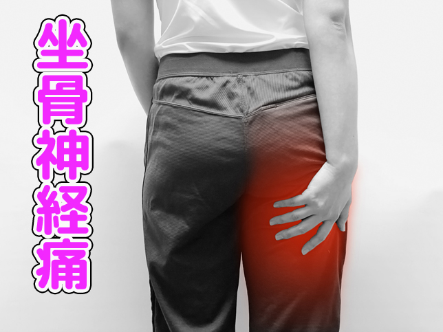 坐骨神経痛